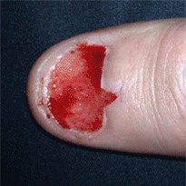 Khám phá cơ chế chịu đau khủng khiếp của con người - Ảnh 5.