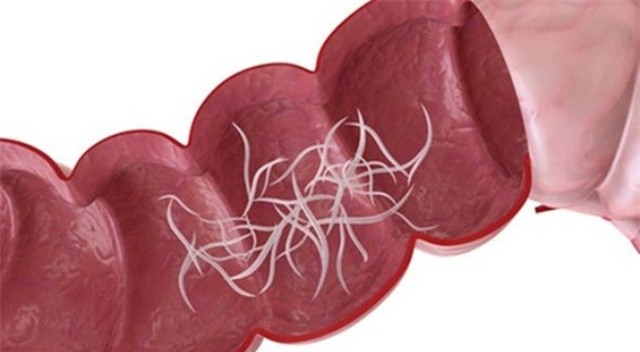 canh giac can benh khien con gay yeu khi di mau giao - 1