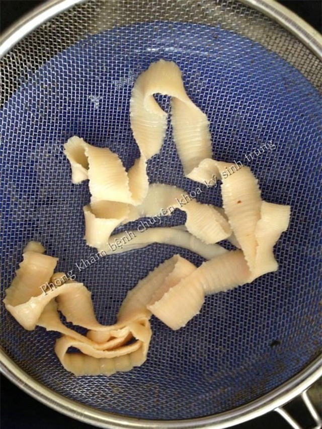 Nguy hiem rinh rap tu bat pho tai hinh anh 2