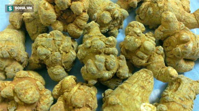 Cảnh báo: Bị phù gan vì uống thuốc bổ tự chế tại nhà - Ảnh 2.