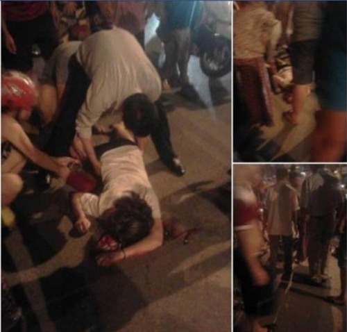 Gái trẻ bị giật túi xách ngã bất tỉnh 'suýt chết' trên phố Hà Nội - Ảnh 1