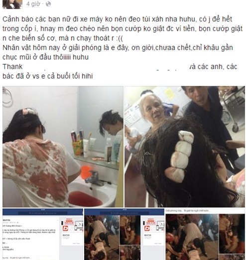 Gái trẻ bị giật túi xách ngã bất tỉnh 'suýt chết' trên phố Hà Nội - Ảnh 2