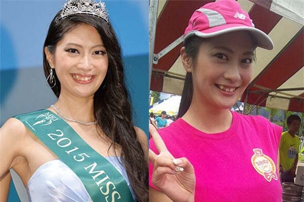 Vẻ ngoài không thật sự nổi bật, đặc biệt là hàm răng khấp khểnh ố vàng của cô nhận vô số lời bình tiêu cực trên mạng. Trang Sina còn trích dẫn cả lời bình của netizen Nhật về Ayano: