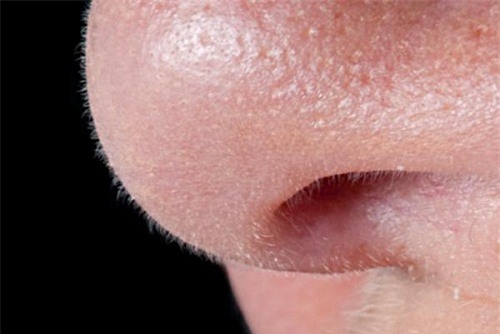 lo-chan-long-blogtamsu1