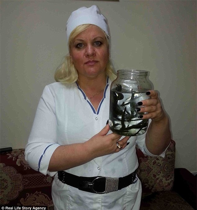 Người phụ nữ giảm được gần 60kg cân vì cho đỉa hút máu thoải mái - Ảnh 2.