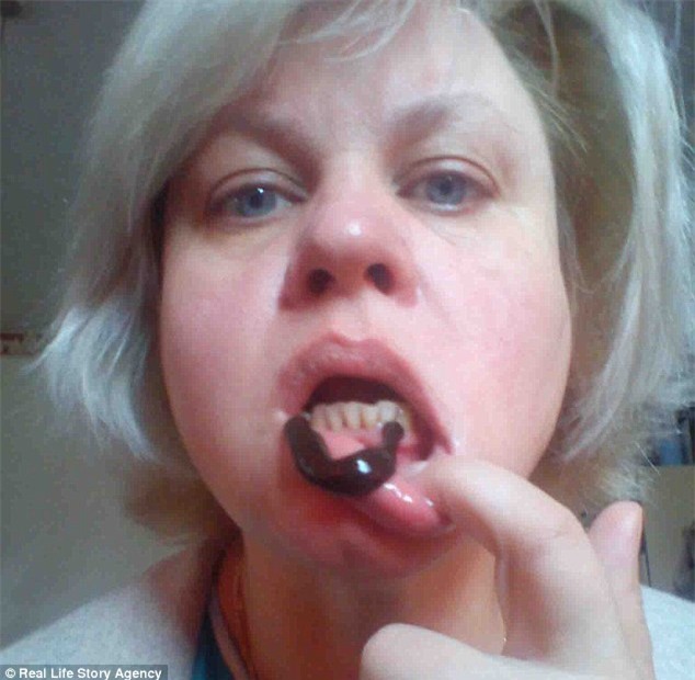 Người phụ nữ giảm được gần 60kg cân vì cho đỉa hút máu thoải mái - Ảnh 3.