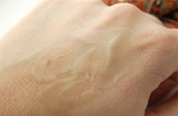 tẩy da chết dạng kỳ ghét