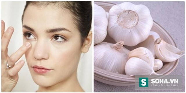 Tỏi không phải là thức ăn lý tưởng dành cho những người bị bệnh về mắt. (Ảnh: nguồn internet).
