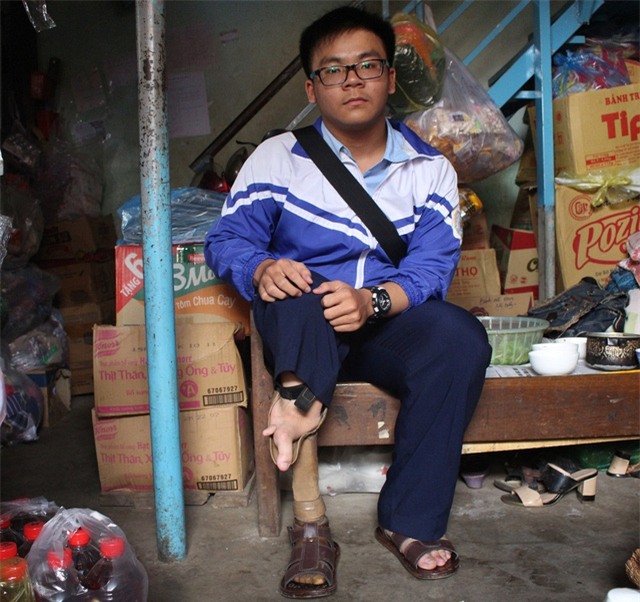 Từ khi sinh ra, Võ Anh Tuấn (học chuyên Toán, Trường THPT Chuyên Hùng Vương, tỉnh Gia Lai) đã bị dị tật bẩm sinh ở chân phải. Lên lớp 5 thì Tuấn được một hội từ thiện giúp đỡ lắp chân giả. Bị dị tật nhưng 12 năm học Tuấn đều là học sinh giỏi. Em thi ngành Y với ước mơ trở thành bác sĩ. (Ảnh: Thiên Thư)