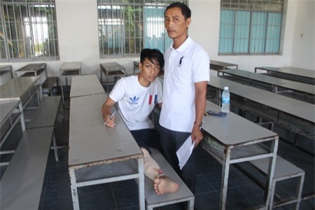 Chân bị gãy, đang bó bột trắng toát, đau nhức… nhưng thí sinh Nguyễn Thành Chung, dự thi THPT quốc gia tại điểm thi ĐH Nha Trang vẫn đến trường thi. Trong ảnh: Hai cha con em Chung trong phòng thi sáng 1/7. (Ảnh: Viết Hảo)