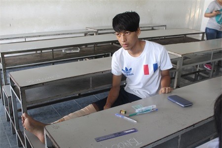 Gãy chân nhưng em Chung vẫn không bỏ thi. (Ảnh: Viết Hảo)