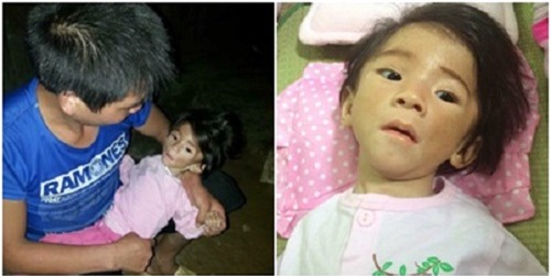 chau be 14 thang nang 3,5kg da tang duoc 350gr, chuan bi xuat vien - 1