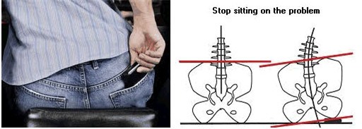 Cất ví tiền sai cách, tất cả nam giới đang phải hứng chịu căn bệnh dai dẳng - Ảnh 3.