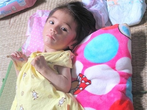 nhieu me tu nguyen den vien cho be 14 thang nang 3,5kg bu hinh anh 1