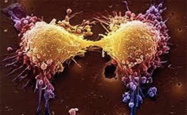 kiềm hóa cơ thể, ung thư, phòng chống ung thư