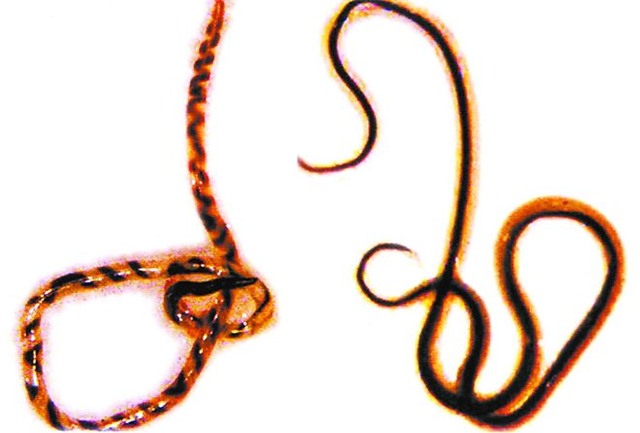 ký sinh trùng, sán