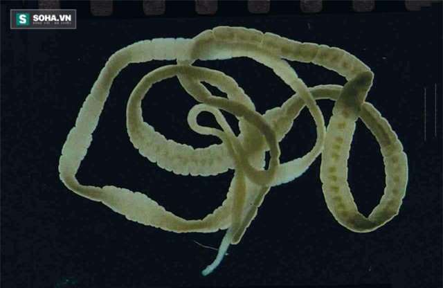 ký sinh trùng, sán