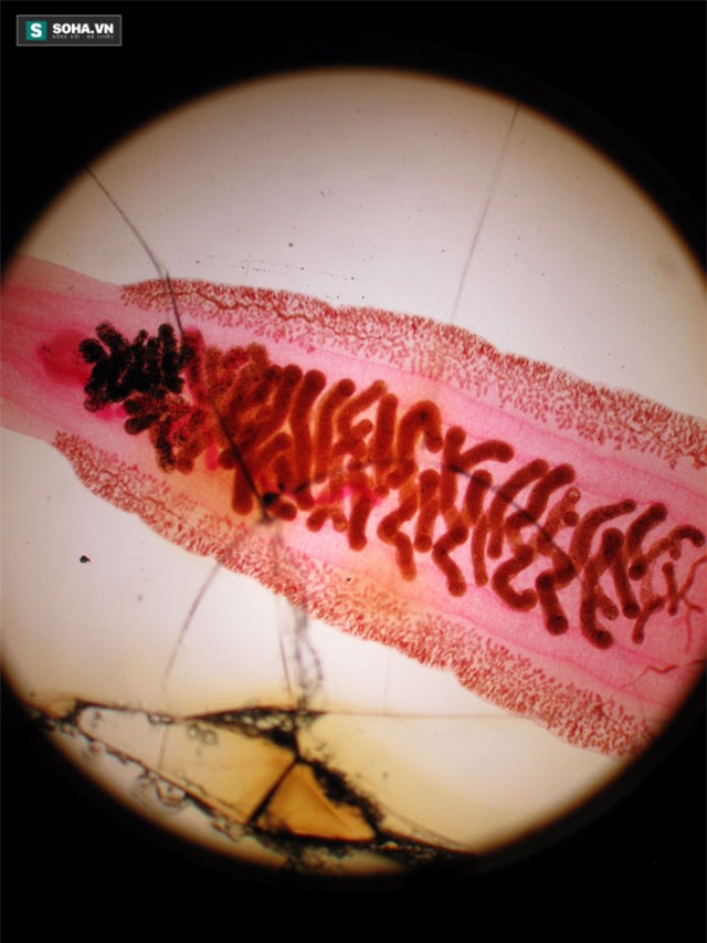 ký sinh trùng, sán