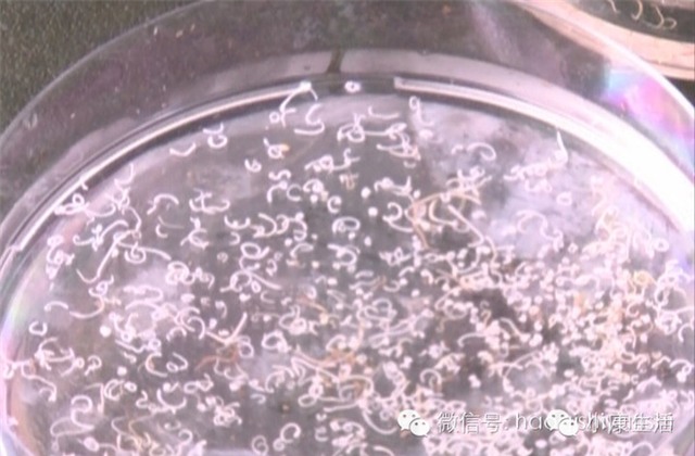 ký sinh trùng, sán