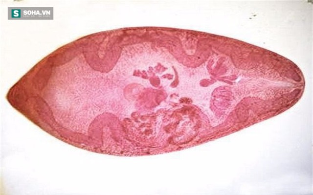 ký sinh trùng, sán