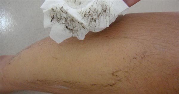 Tẩy lông bằng oxi già