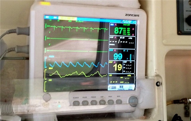 Anh C. khẳng định xe cứu thương của công ty anh được trang bị đầy đủ trang thiết bị y tế cần thiết, đảm bảo cho việc vận chuyển bệnh nhân.