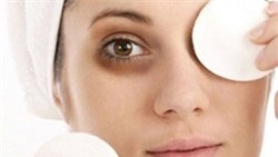 Chữa thâm mắt hiệu quả mà không tốn tiền