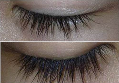 long-mi-blogtamsuvn6