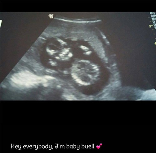 gap lai em be ky dieu sinh ra voi nua hop so chan dong the gioi - 1