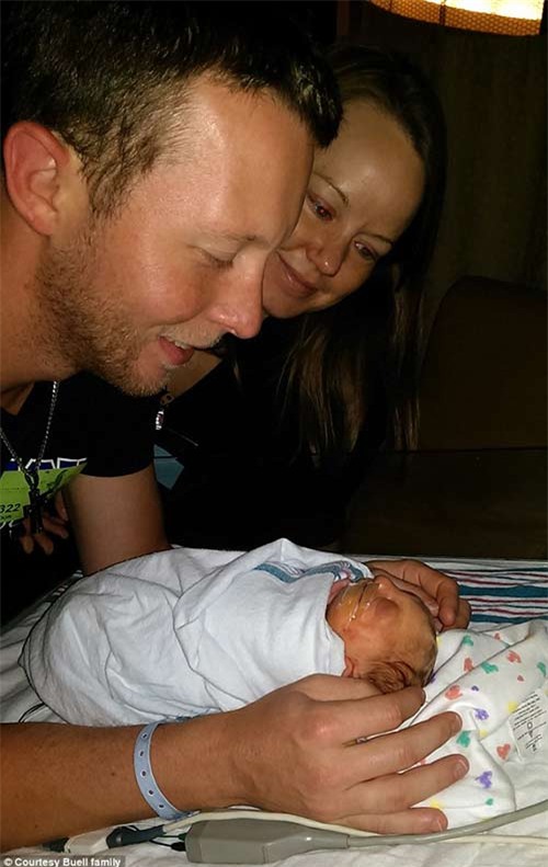 gap lai em be ky dieu sinh ra voi nua hop so chan dong the gioi - 4