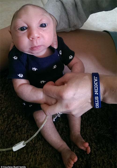 gap lai em be ky dieu sinh ra voi nua hop so chan dong the gioi - 5