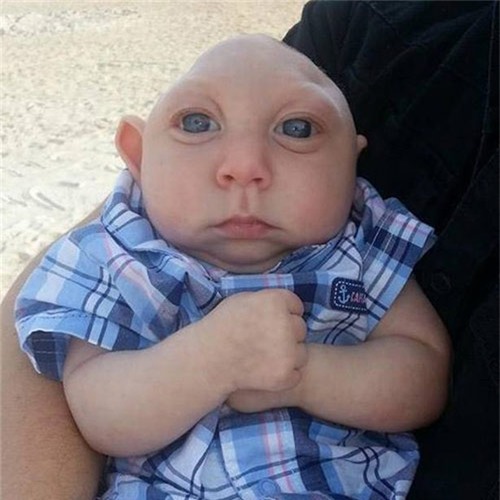 gap lai em be ky dieu sinh ra voi nua hop so chan dong the gioi - 9