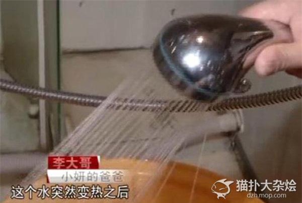 Được mẹ tắm cho bằng vòi hoa sen, bé gái bỏng toàn thân nguy kịch - Ảnh 2.