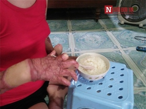 Giây phút khủng khiếp người vợ trẻ đẹp bị chồng tẩm xăng thiêu sống