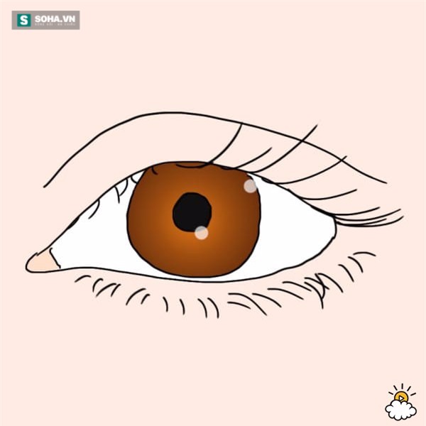Nhìn mắt bắt bệnh - Ảnh 2.