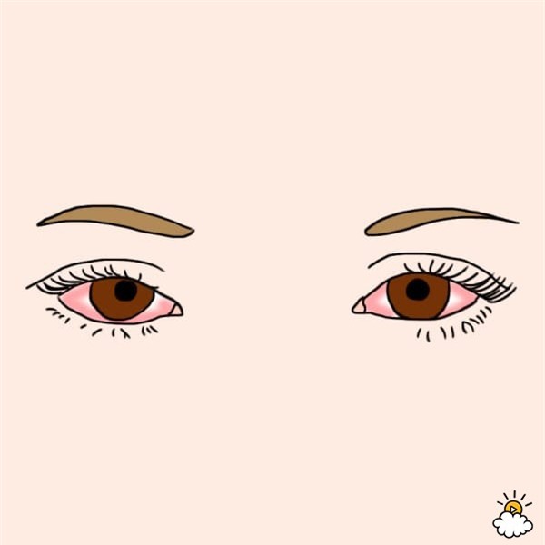 Nhìn mắt bắt bệnh - Ảnh 4.