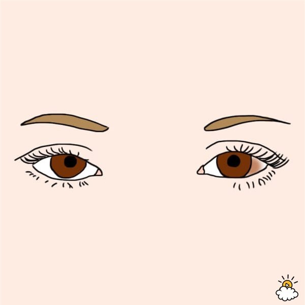 Nhìn mắt bắt bệnh - Ảnh 5.