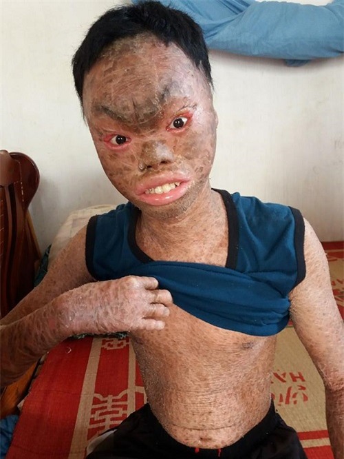 xot xa canh bo bi tam than, me mac benh tim cham con trai la “nguoi vay ca” - 2