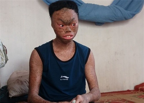 xot xa canh bo bi tam than, me mac benh tim cham con trai la “nguoi vay ca” - 5