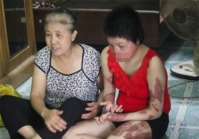 Nguoi bi chong tuoi xang dot: Con thay mat toi la khoc thet hinh anh 1