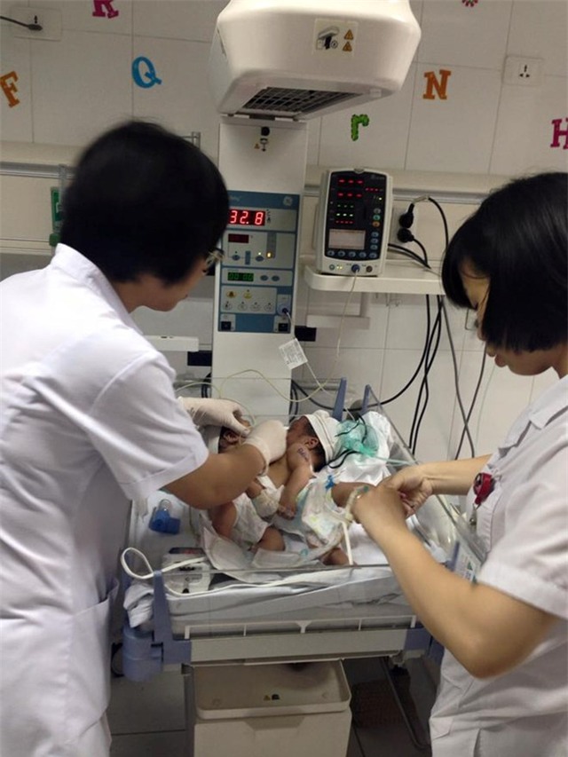 Bác sĩ ra chợ xin từ thiện cứu 2 bé song sinh dính liền: Bị trách nhưng vẫn vui - Ảnh 3.