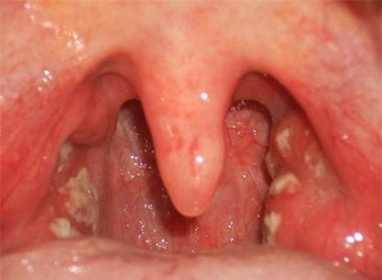 bach-hau-1468467415810-4-0-474-640-crop-1468467438946