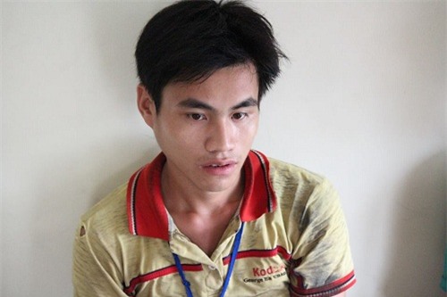 bo cua 2 be so sinh dinh lien: 'toi run ban nguoi khi thay hai con bi dinh nguc, bung' - 2