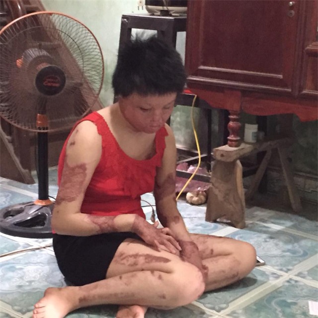 Con khóc thét khi nhìn khuôn mặt mẹ sau cơn “điên” của bố - 3