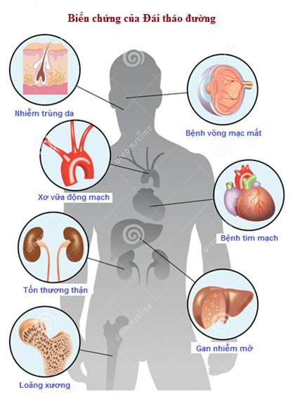 Tiểu đường: Bệnh hiểm đã tấn công cả trẻ em - Ảnh 5.