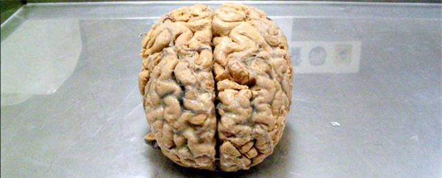Liệu con người có tồn tại nếu... không có não? - Ảnh 1.
