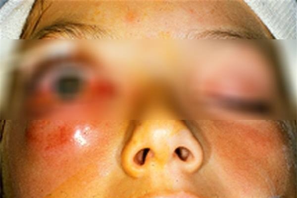 Hàng triệu người vô tư nhổ lông mũi mà không biết tác hại kinh hoàng này! - Ảnh 5.