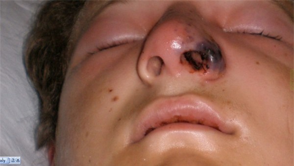 Hàng triệu người vô tư nhổ lông mũi mà không biết tác hại kinh hoàng này! - Ảnh 7.