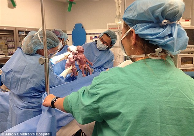 2 cô nhóc nổi tiếng trong bức ảnh cặp sinh đôi nắm chặt tay khi mới sinh giờ ra sao? - Ảnh 1.