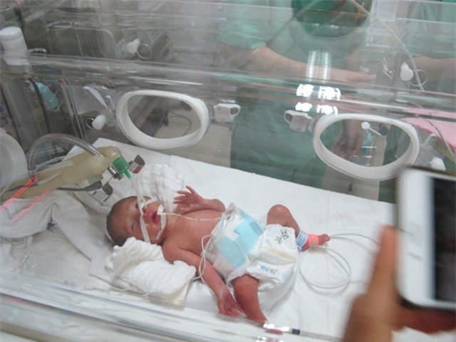 Bé Trần Gấu được nuôi dưỡng hoàn toàn bằng đường tĩnh mạch. Ảnh: N.P